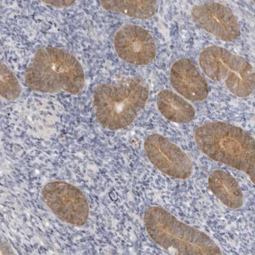 Immunohistochemistry-Paraffin: gamma-Glutamylcyclotransferase/CRF21/GGCT Antibody [NBP1-86727] - Staining of human corpus, uterine shows moderate cytoplasmic positivity in glandular cells.