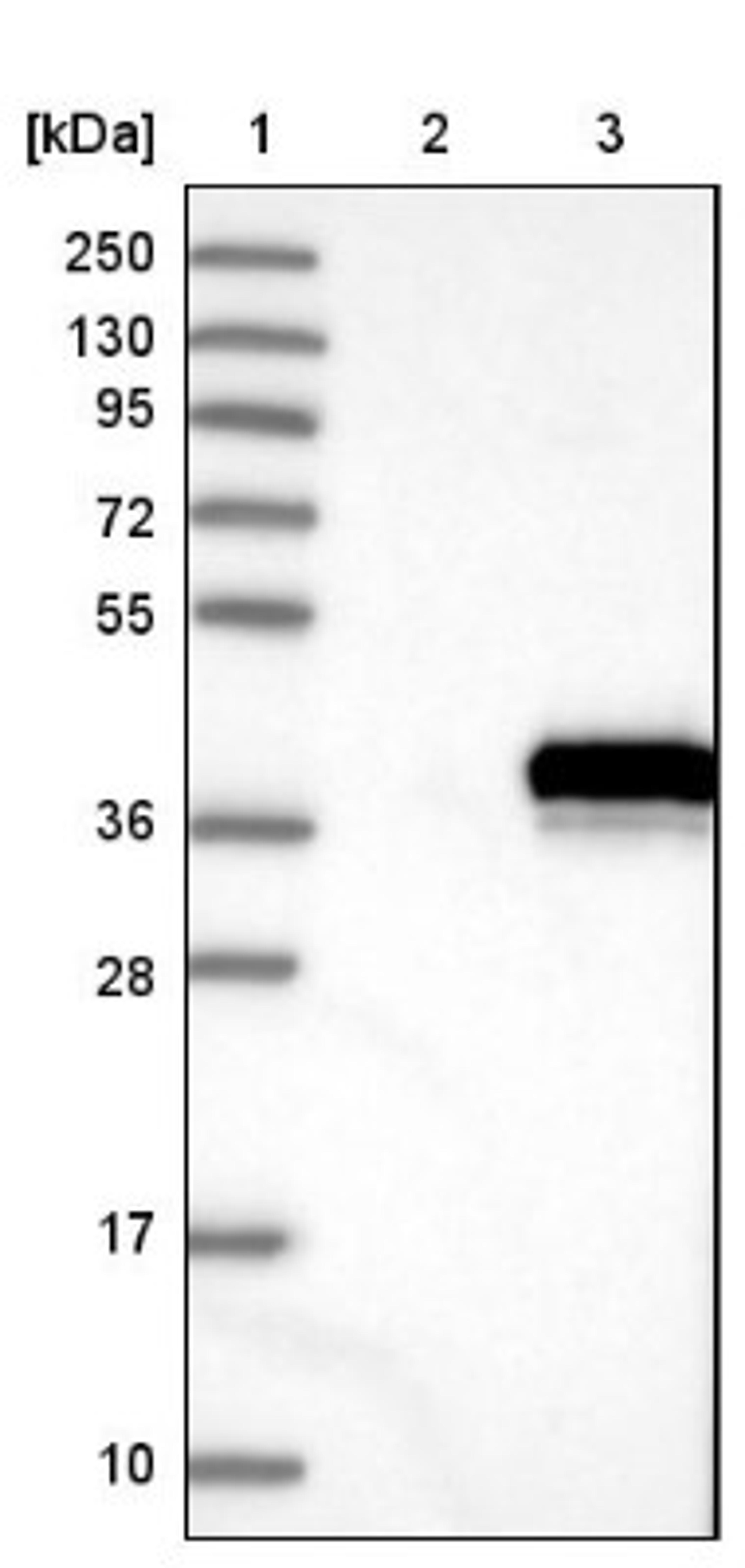 Western Blot: ELMOD1 Antibody [NBP1-85094] - Lane 1: Marker [kDa] 250, 130, 95, 72, 55, 36, 28, 17, 10<br/>Lane 2: Negative control (vector only transfected HEK293T lysate)<br/>Lane 3: Over-expression lysate (Co-expressed with a C-terminal myc-DDK tag (~3.1 kDa) in mammalian HEK293T cells, LY412885)