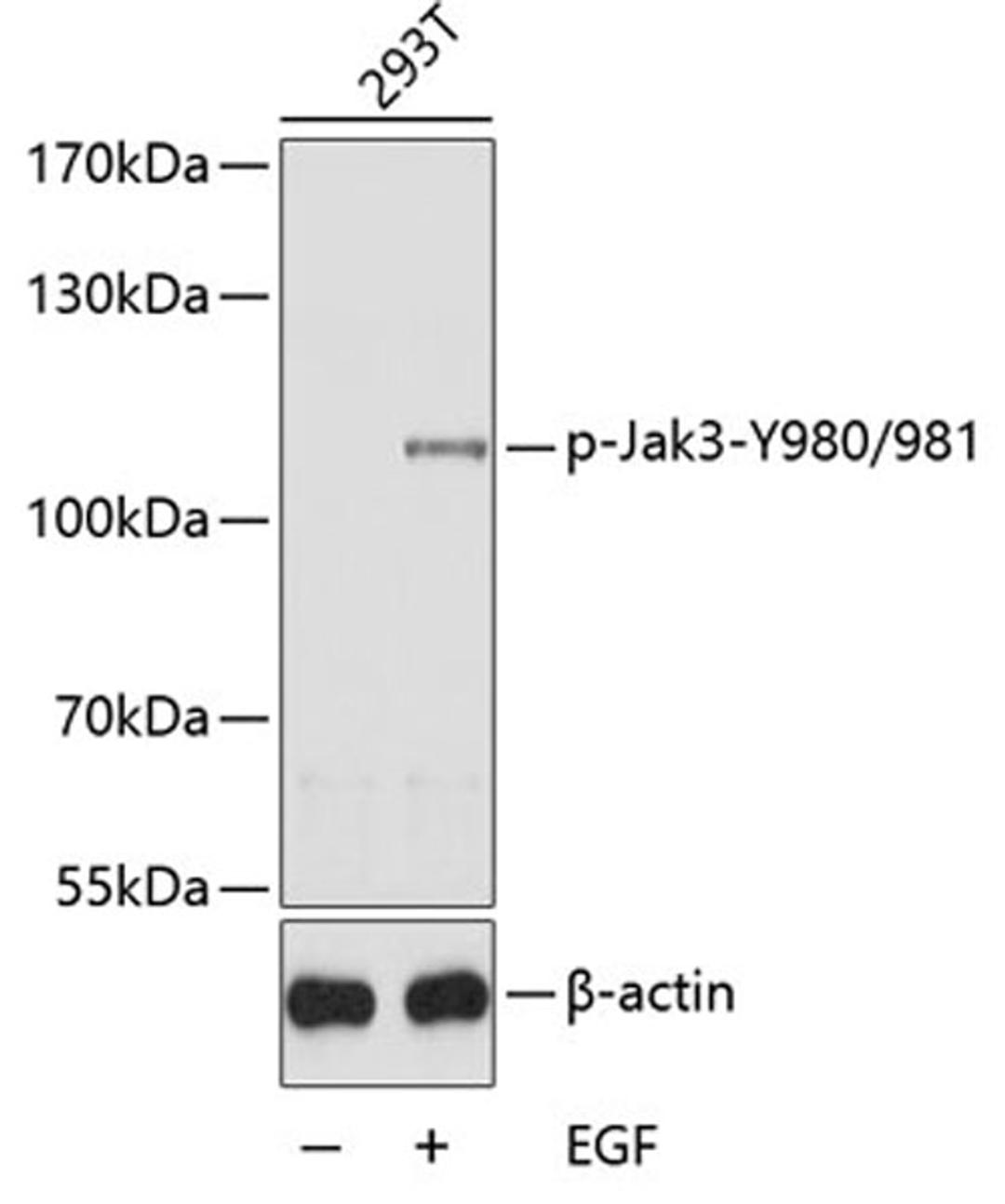 Western blot - Phospho-Jak3-Y980/981 antibody (AP0532)