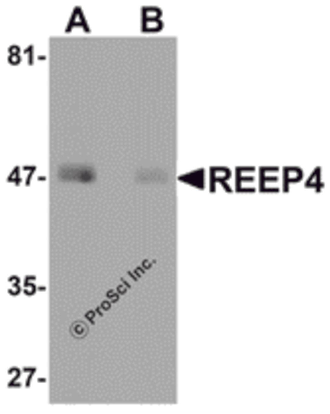 Western blot analysis of REEP4 in human lung tissue lysate with REEP4 antibody at 1 &#956;g/ml in (A) the absence and (B) the presence of blocking peptide.