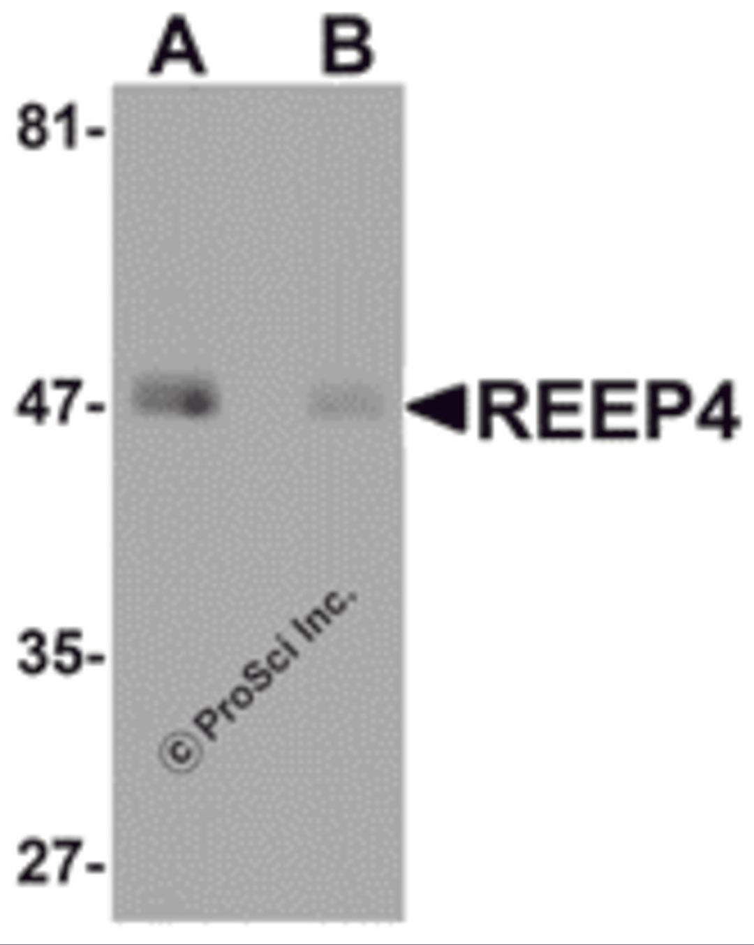 Western blot analysis of REEP4 in human lung tissue lysate with REEP4 antibody at 1 μg/ml in (A) the absence and (B) the presence of blocking peptide.