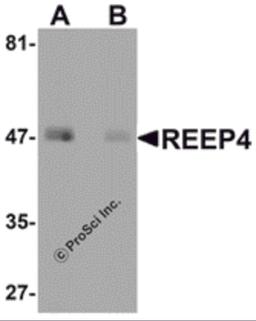 Western blot analysis of REEP4 in human lung tissue lysate with REEP4 antibody at 1 μg/ml in (A) the absence and (B) the presence of blocking peptide.