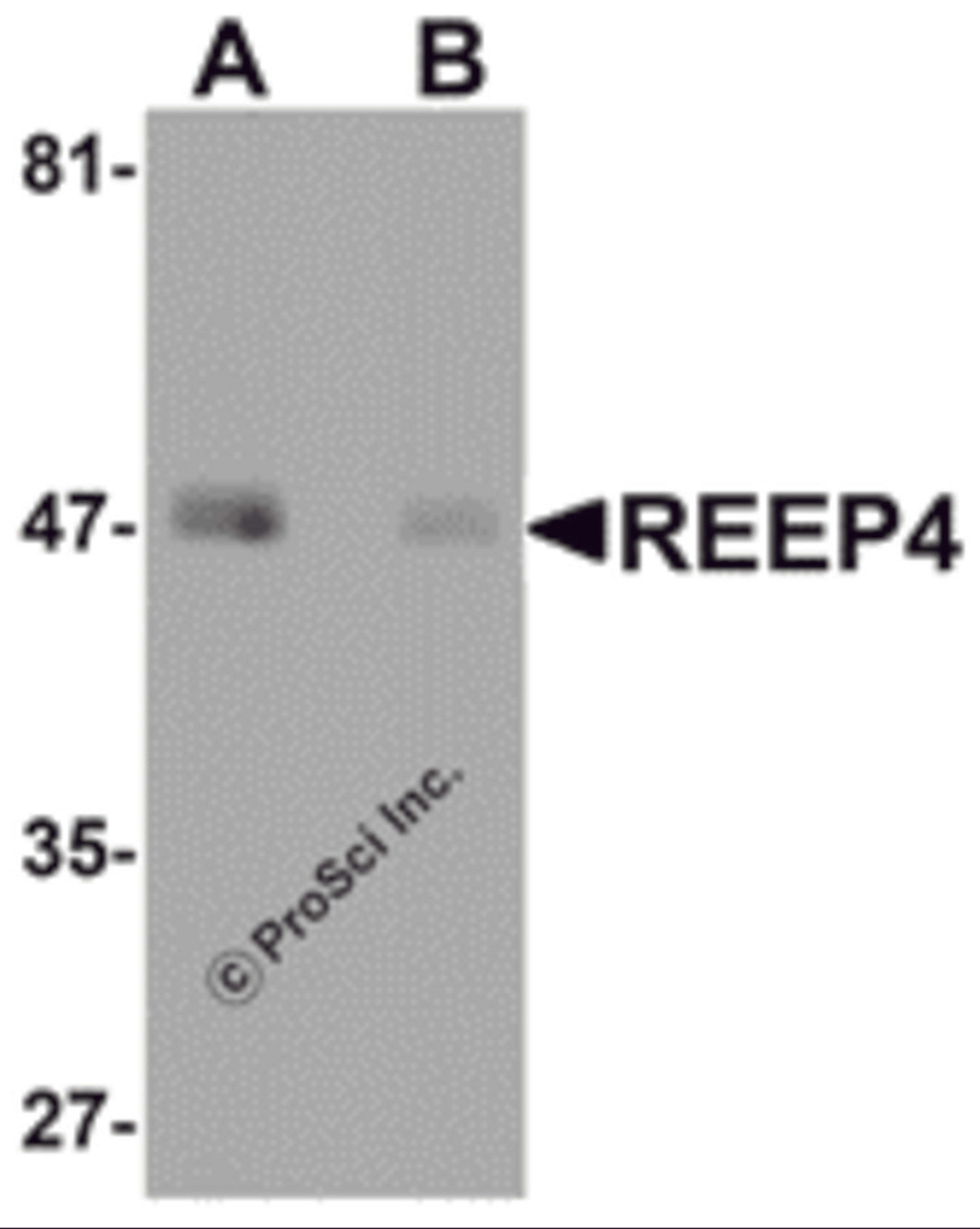 Western blot analysis of REEP4 in human lung tissue lysate with REEP4 antibody at 1 μg/ml in (A) the absence and (B) the presence of blocking peptide.