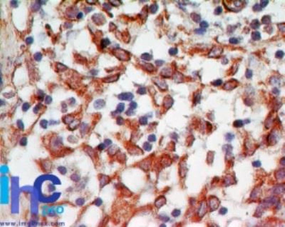 Immunohistochemistry-Paraffin: RANKL Antibody (12A668) [NB100-56512] - Formalin-fixed, paraffin-embedded human lymph node (IMH-346) probed with Trance antibody at 5 ug/ml.    Staining of formalin-fixed tissues is enhanced by boiling tissue sections in 10 mM sodium citrate buffer, pH 6.0 for 10-20 min followed by cooling at RT for 20 min.