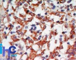 Immunohistochemistry-Paraffin: RANKL Antibody (12A668) [NB100-56512] - Formalin-fixed, paraffin-embedded human lymph node (IMH-346) probed with Trance antibody at 5 ug/ml.    Staining of formalin-fixed tissues is enhanced by boiling tissue sections in 10 mM sodium citrate buffer, pH 6.0 for 10-20 min followed by cooling at RT for 20 min.