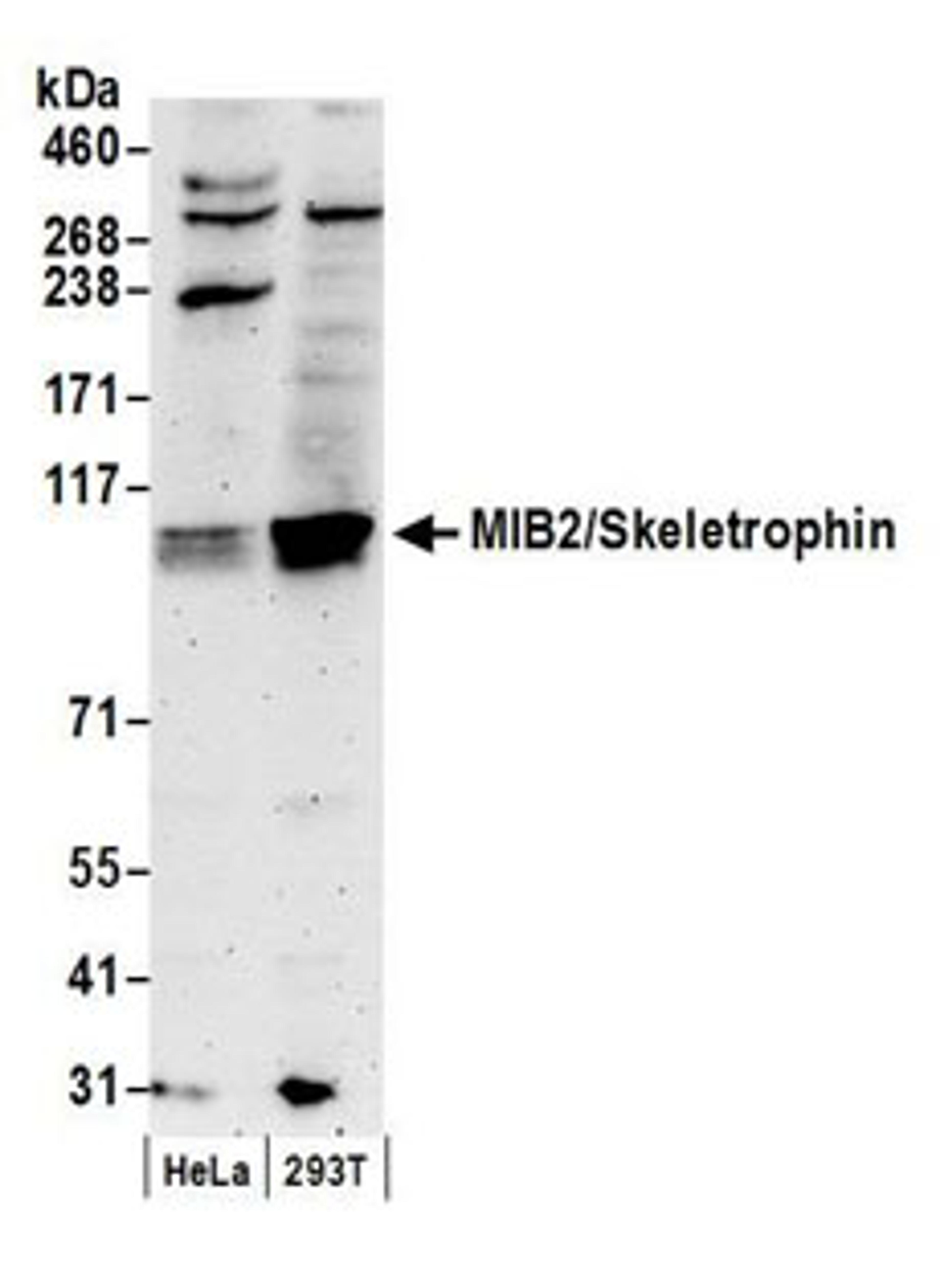 Detection of human MIB2/Skeletrophin by western blot.