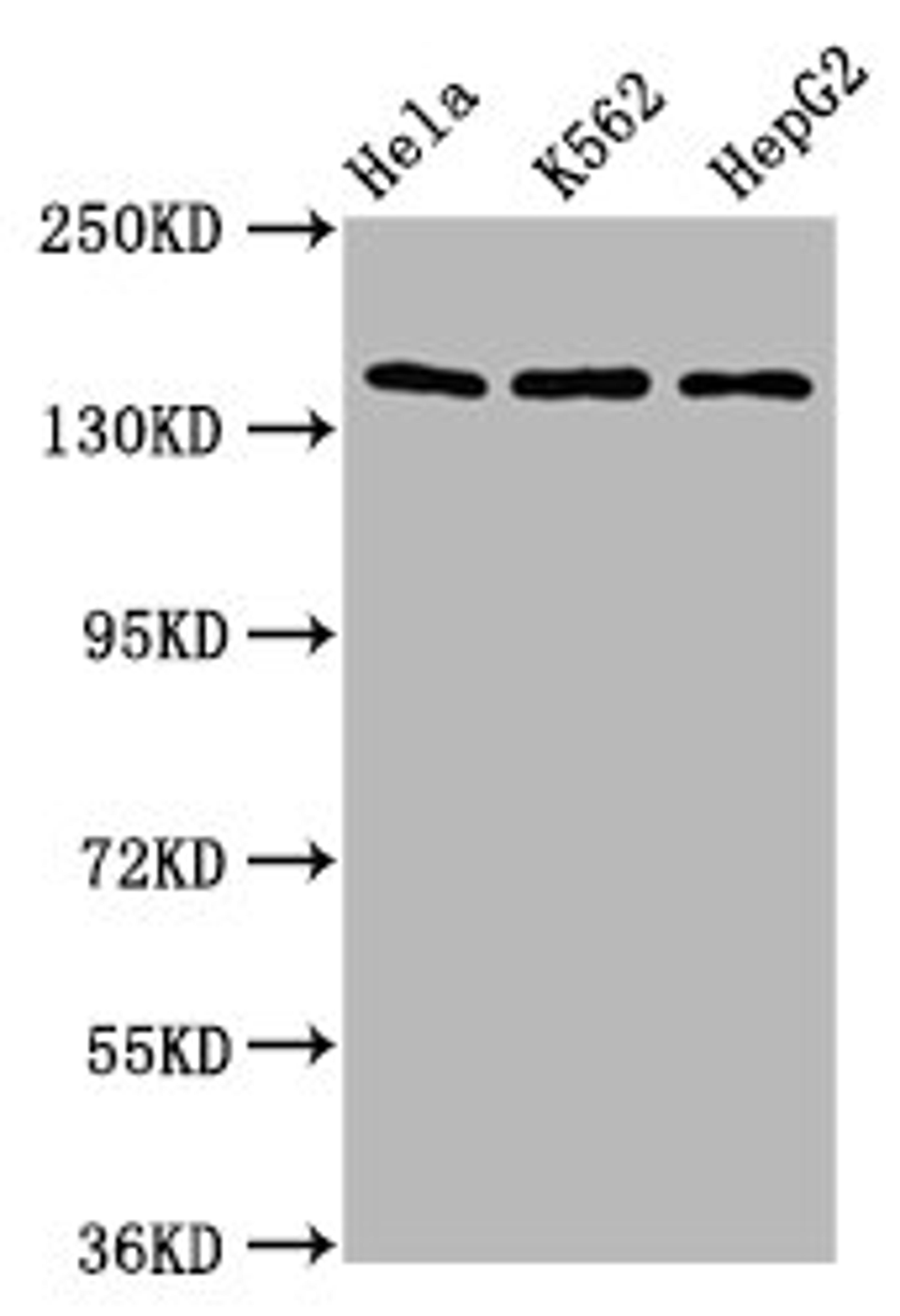 Western Blot. Positive WB detected in: Hela whole cell lysate, K562 whole cell lysate, HepG2 whole cell lysate. All lanes: SF3B1 antibody at 9.8µg/ml. Secondary. Goat polyclonal to rabbit IgG at 1/50000 dilution. Predicted band size: 146, 17 kDa. Observed band size: 146 kDa
