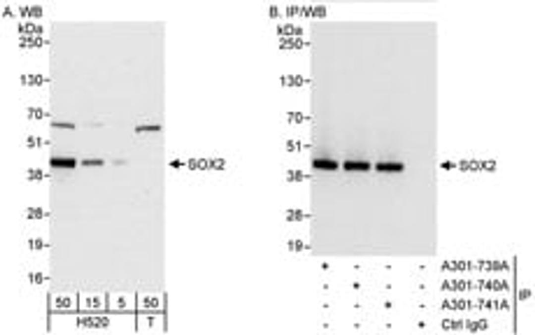 Detection of human SOX2 by western blot and immunoprecipitation.