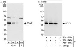 Detection of human SOX2 by western blot and immunoprecipitation.