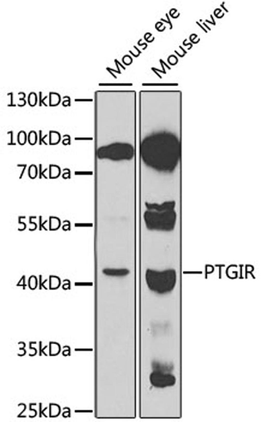 Western blot - PTGIR antibody (A1849)