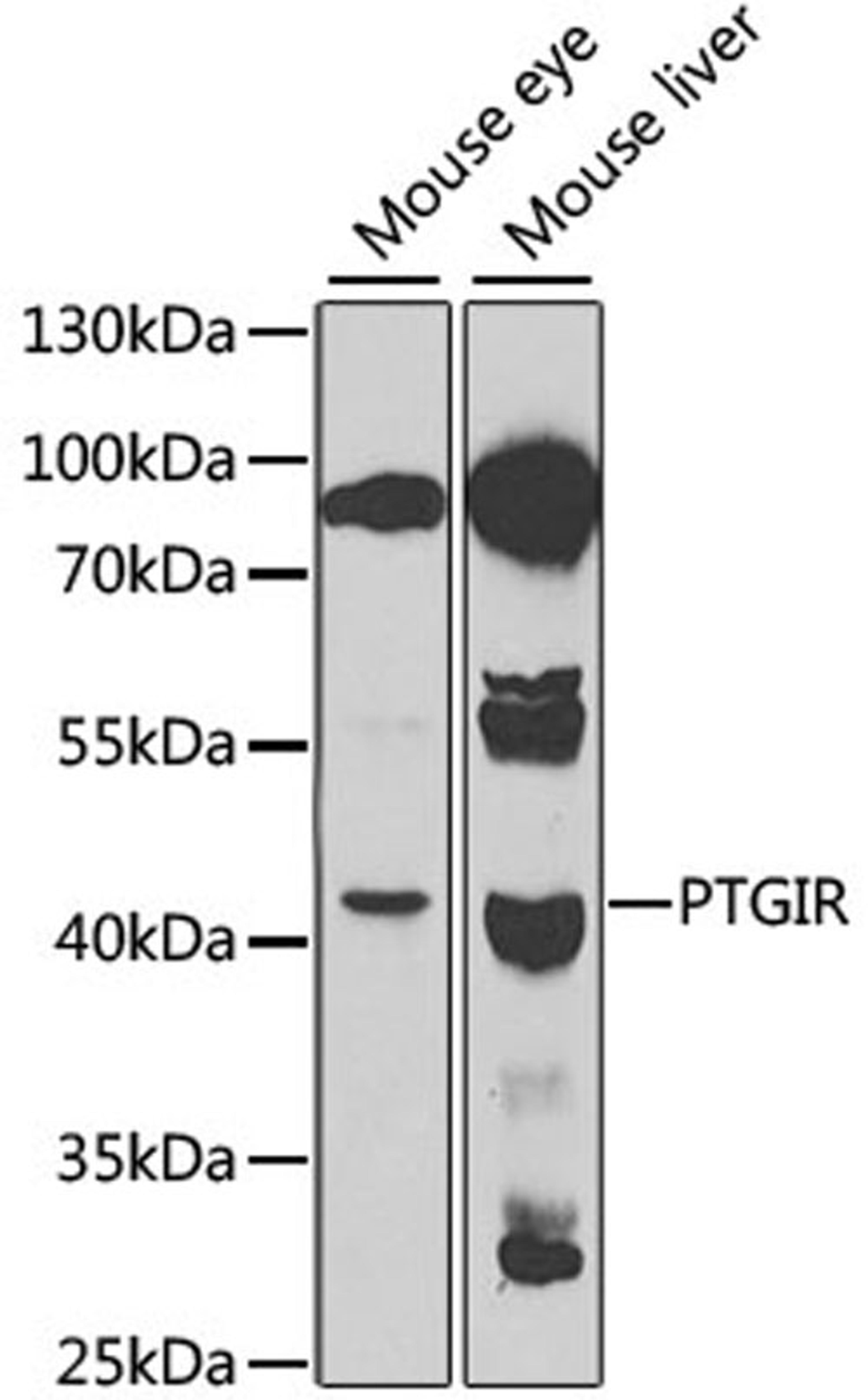 Western blot - PTGIR antibody (A1849)