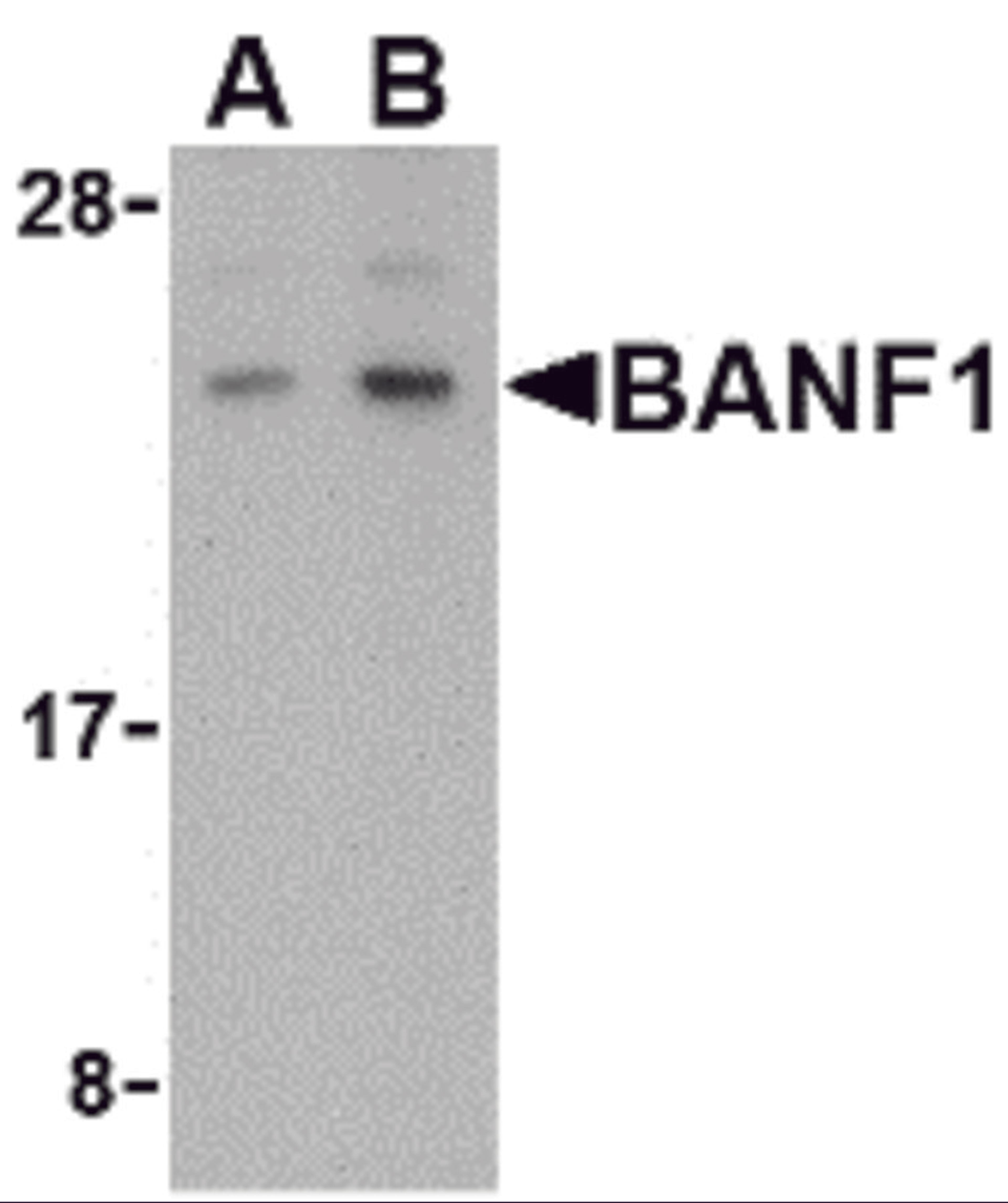 Western blot analysis of BANF1 in human kidney tissue lysate with BANF1 antibody at (A) 0.5 and (B) 1 &#956;g/mL. 