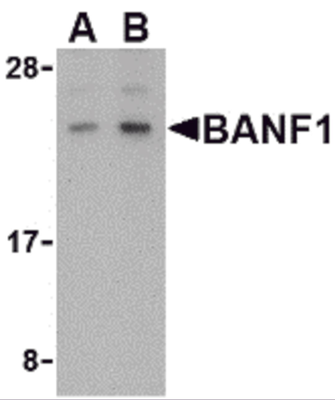 Western blot analysis of BANF1 in human kidney tissue lysate with BANF1 antibody at (A) 0.5 and (B) 1 μg/mL.