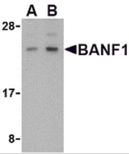 Western blot analysis of BANF1 in human kidney tissue lysate with BANF1 antibody at (A) 0.5 and (B) 1 μg/mL.