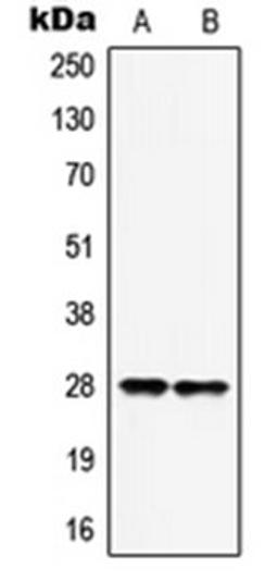 Western blot analysis of MCF7 (Lane 1), HepG2 (Lane 2) whole cell lysates using HOXB9 antibody