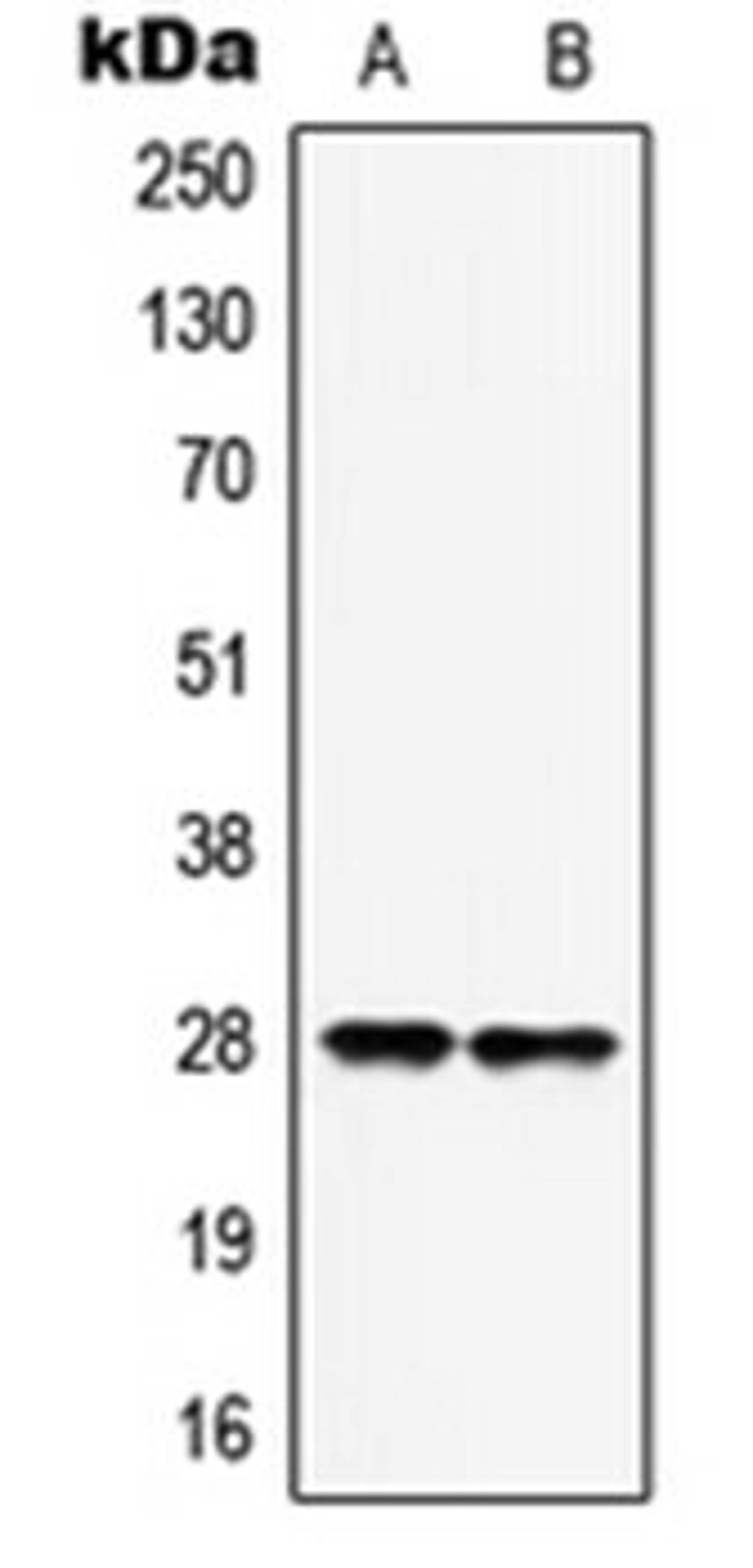 Western blot analysis of MCF7 (Lane 1), HepG2 (Lane 2) whole cell lysates using HOXB9 antibody