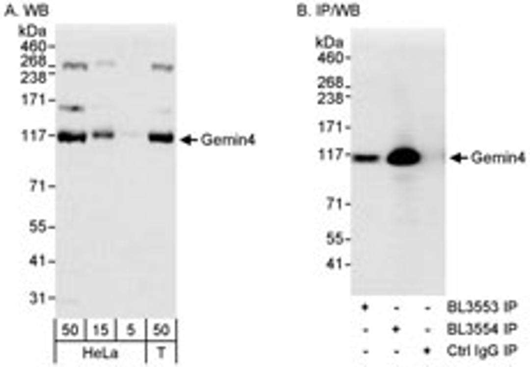 Detection of human Gemin4 by western blot and immunoprecipitation.