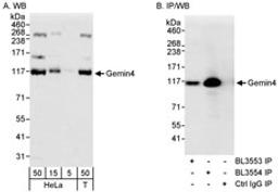 Detection of human Gemin4 by western blot and immunoprecipitation.