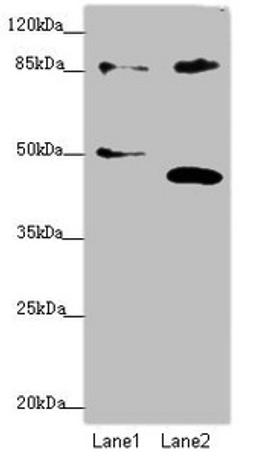 Western blot. All lanes: TAF5 antibody at 1.74 ug/ml. Lane 1: Jurkat whole cell lysate. Lane 2: MCF-7 whole cell lysate. Secondary. Goat polyclonal to rabbit IgG at 1/10000 dilution. Predicted band size: 87, 81 kDa. Observed band size: 87, 40, 51 kDa. 