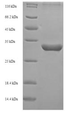 (Tris-Glycine gel) Discontinuous SDS-PAGE (reduced) with 5% enrichment gel and 15% separation gel.
