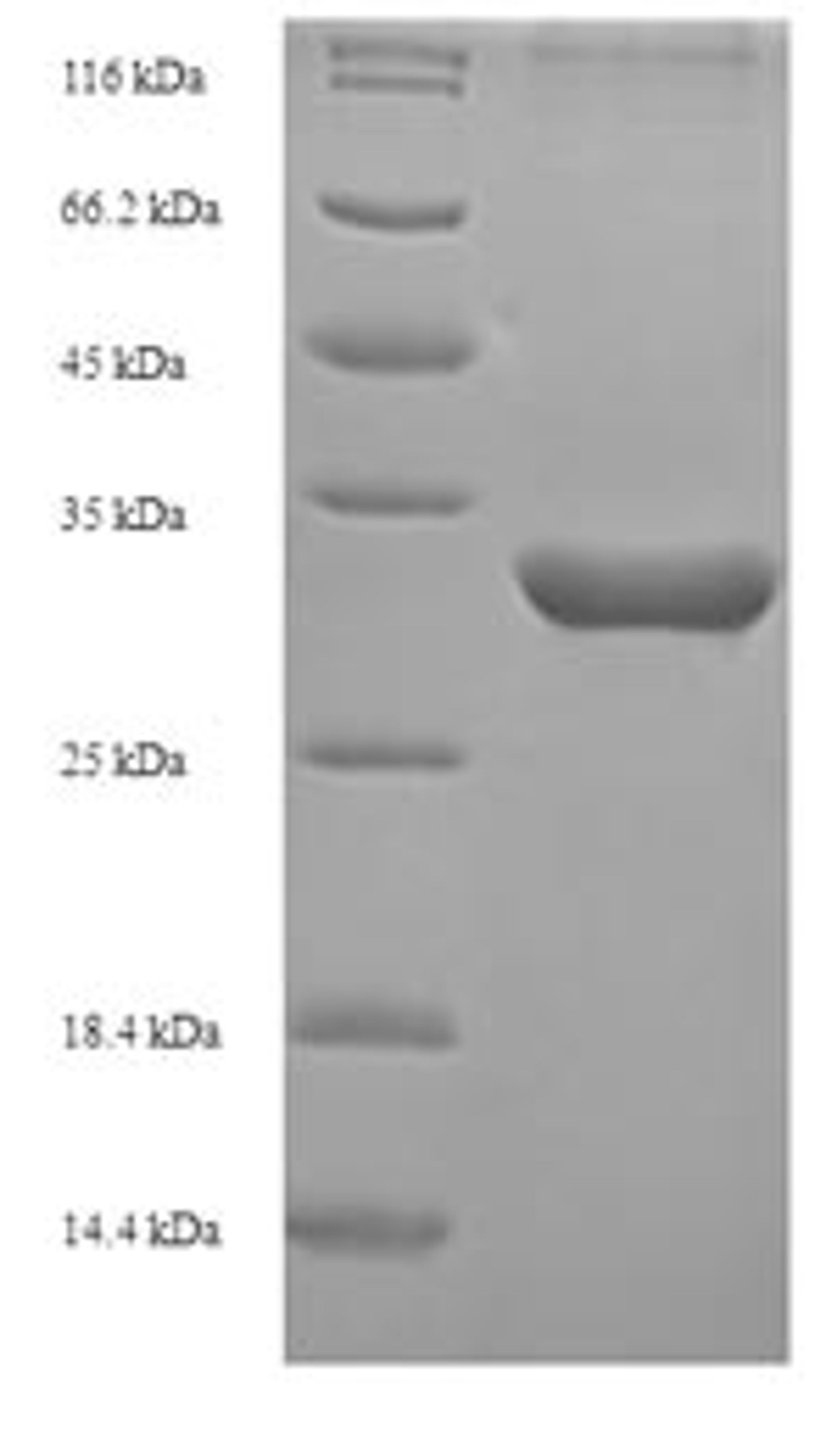 (Tris-Glycine gel) Discontinuous SDS-PAGE (reduced) with 5% enrichment gel and 15% separation gel.