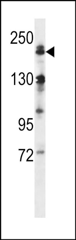 Western blot analysis in human normal Uterus tissue lysates (35ug/lane).