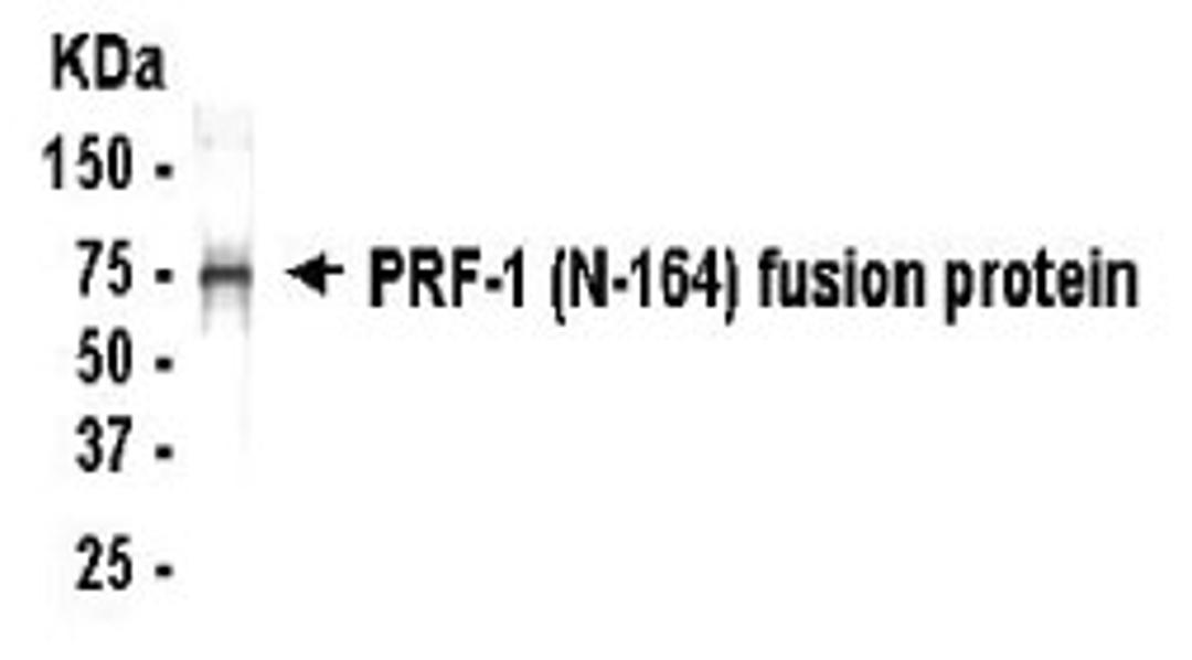 Western blot detection of PRF-1 (N-164) antibody.