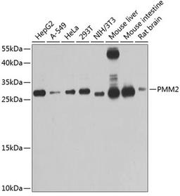 Western blot - PMM2 antibody (A4026)