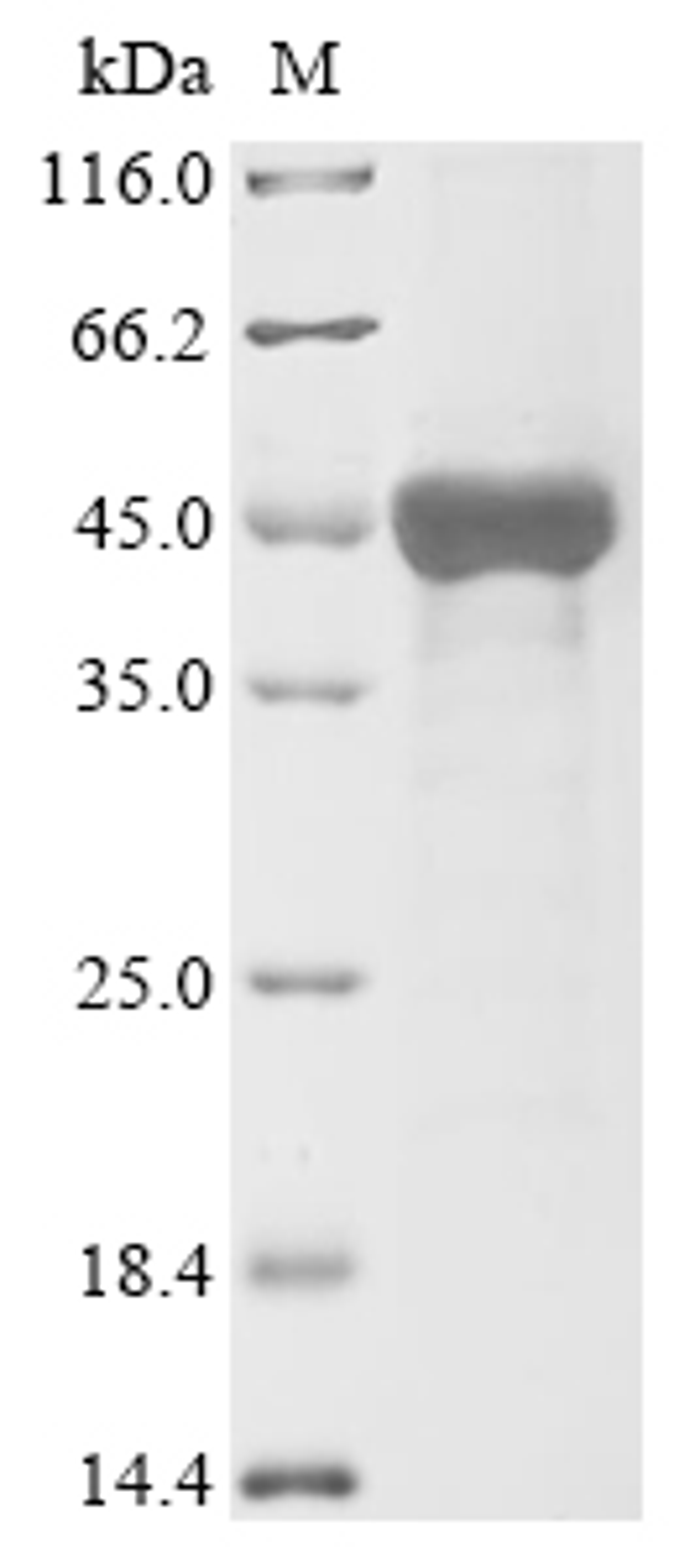 (Tris-Glycine gel) Discontinuous SDS-PAGE (reduced) with 5% enrichment gel and 15% separation gel.