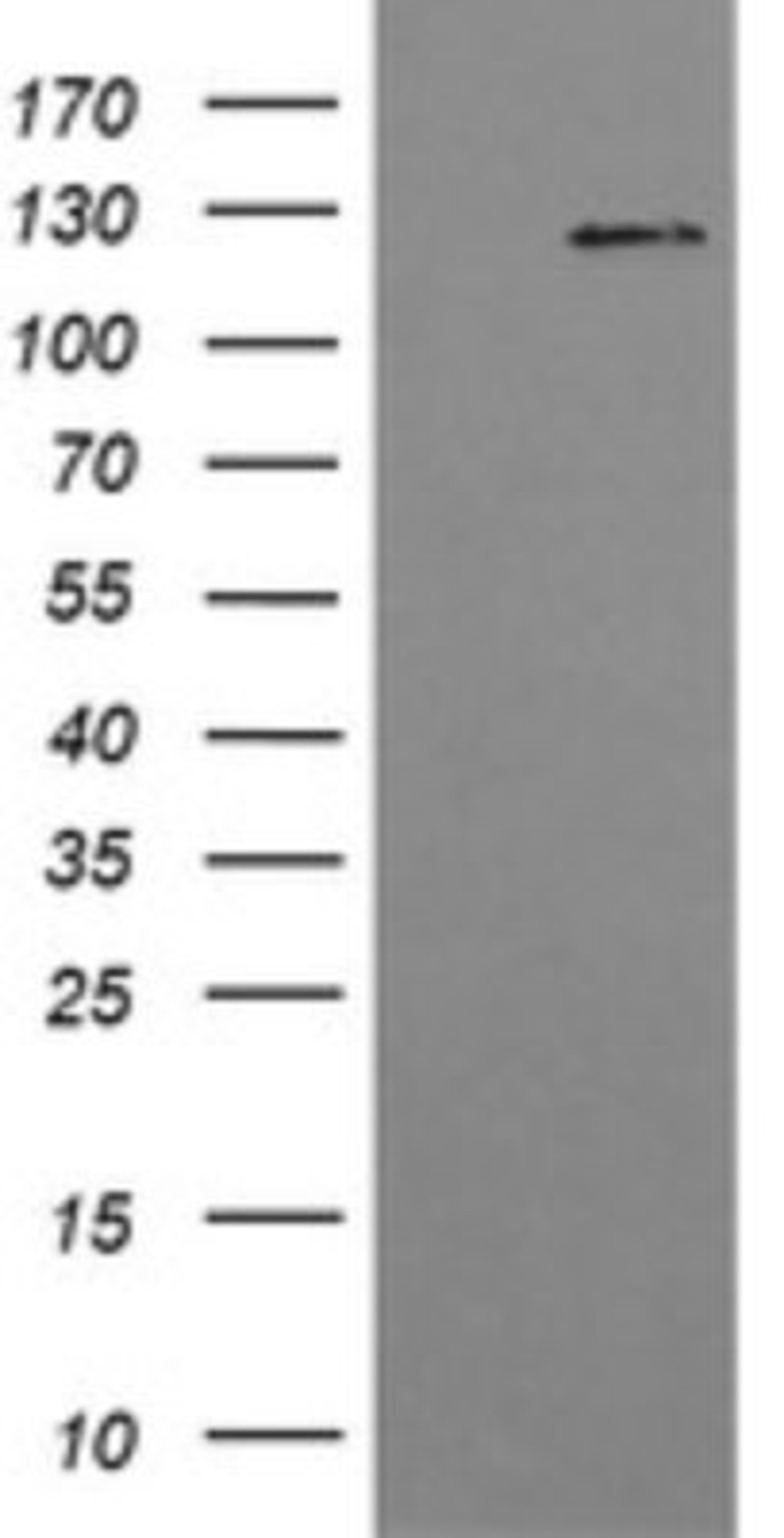 Western Blot: PI 3-Kinase p110 gamma Antibody (2B1) [NBP2-46411] - Analysis of HEK293T cells were transfected with the pCMV6-ENTRY control (Left lane) or pCMV6-ENTRY PI 3-Kinase p110.