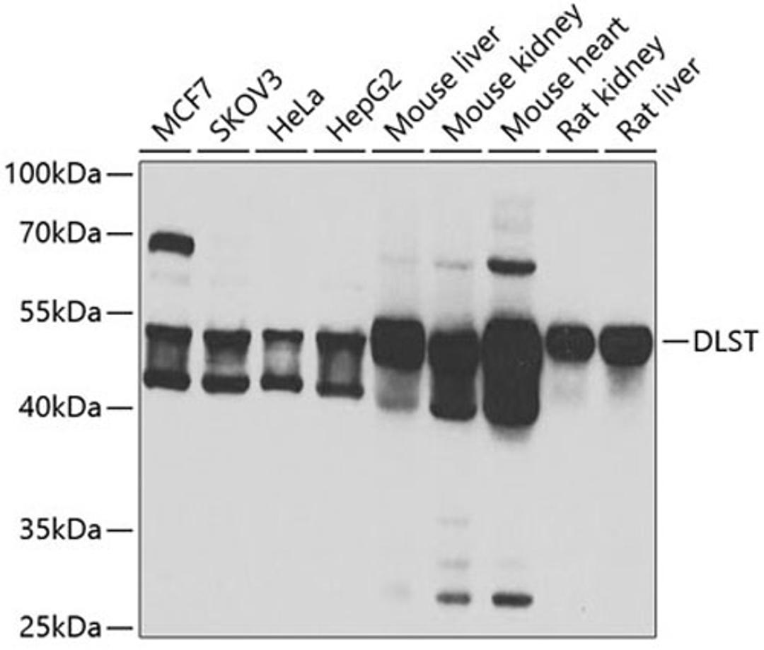 Western blot - DLST antibody (A6901)