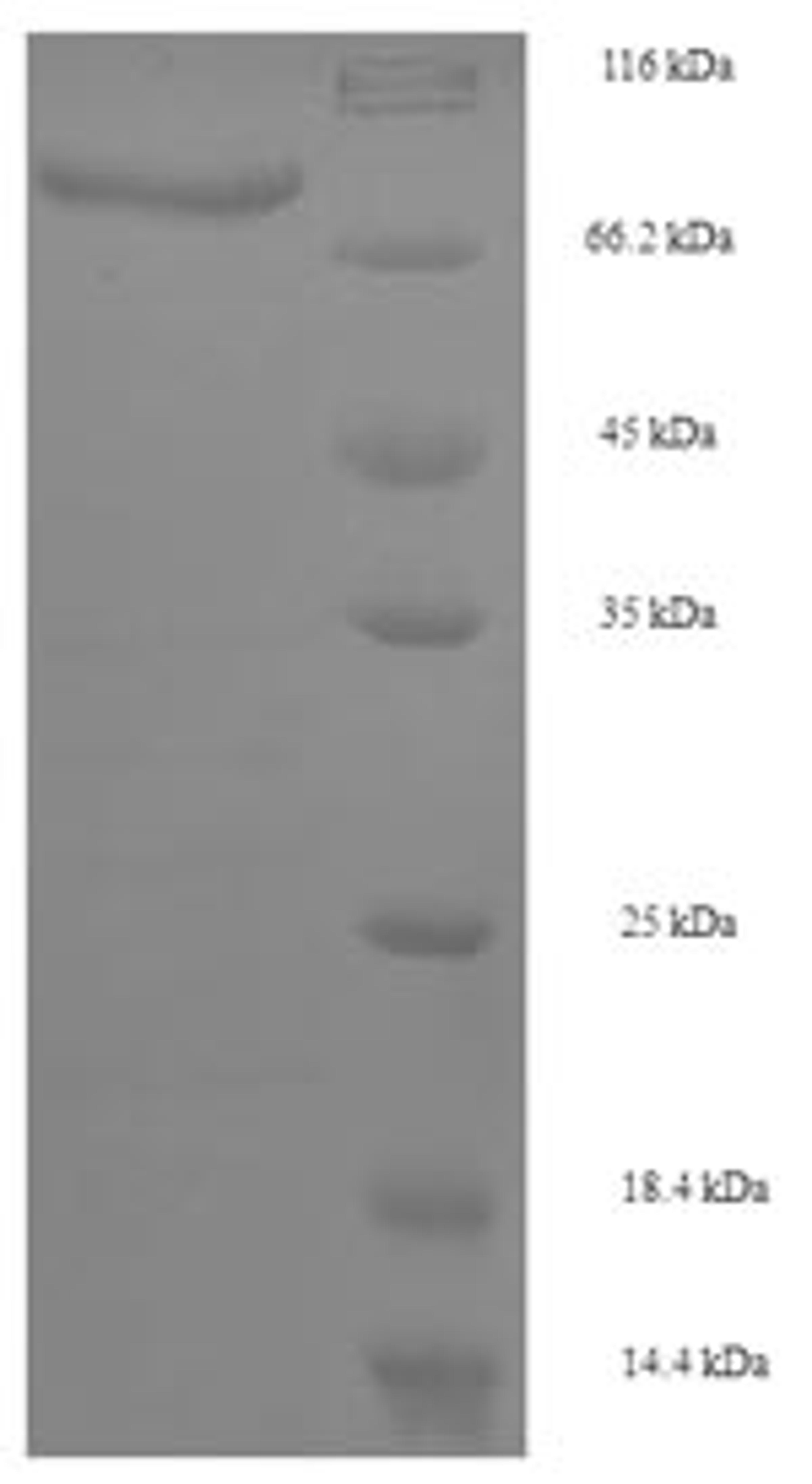 (Tris-Glycine gel) Discontinuous SDS-PAGE (reduced) with 5% enrichment gel and 15% separation gel.