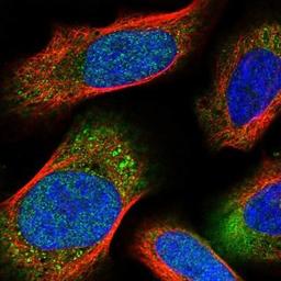 Immunocytochemistry/Immunofluorescence: Isoleucyl tRNA synthetase Antibody [NBP1-87698] - Staining of human cell line U-251MG shows positivity in nucleus but not nucleoli & cytoplasm.