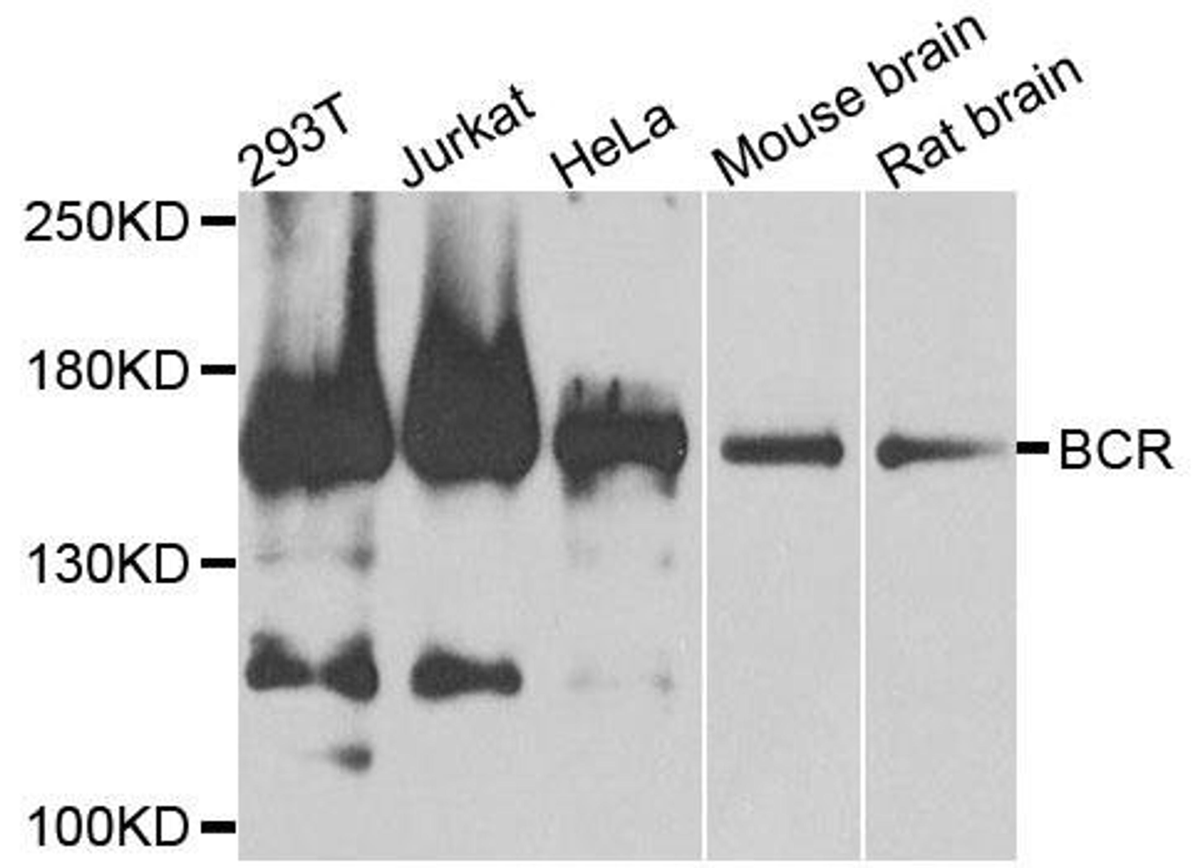 Western blot analysis of extracts of various cells using BCR antibody