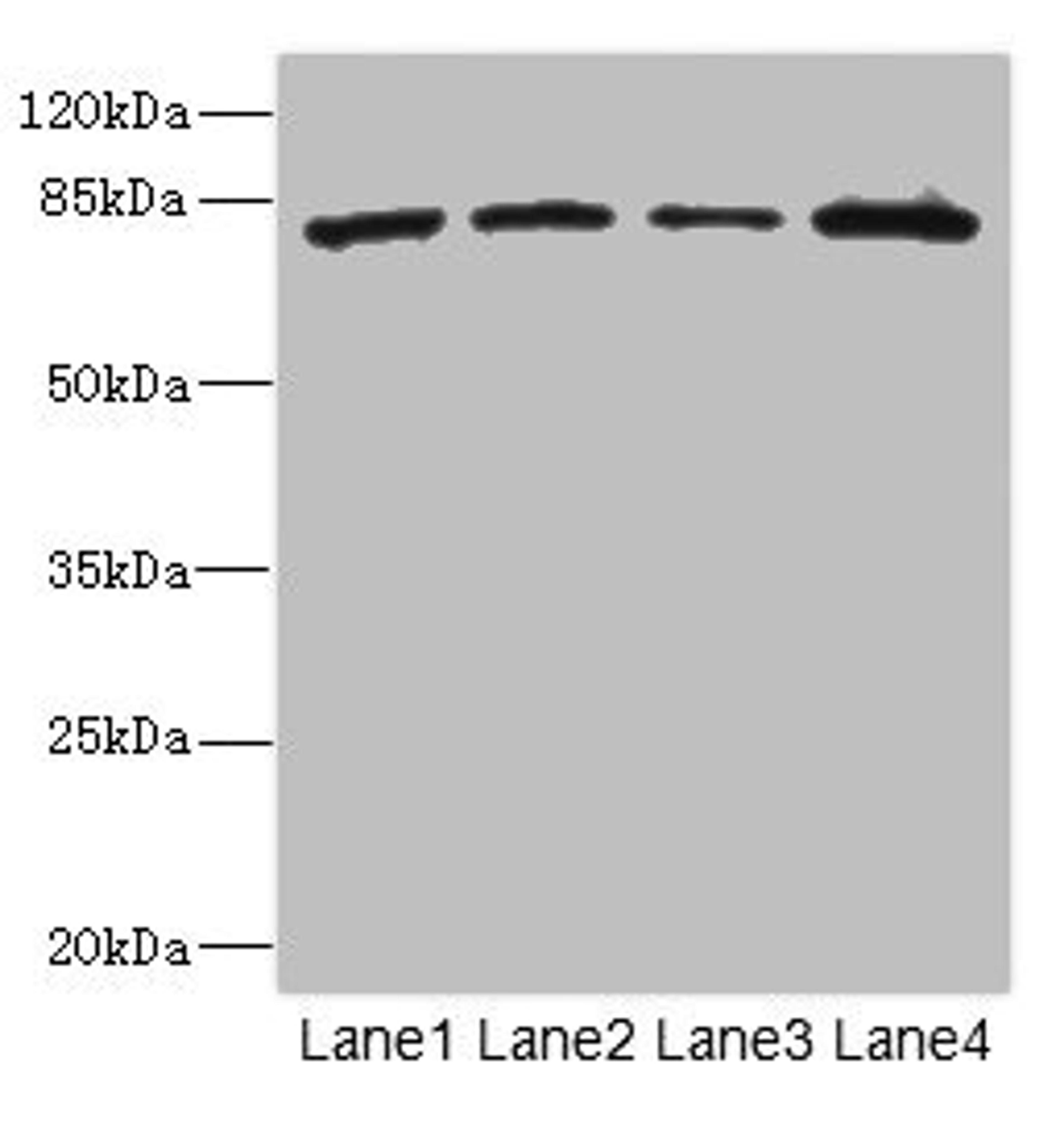 Western blot. All lanes: ZP2 antibody at 3.06ug/ml. Lane 1: 293T whole cell lysate. Lane 2: Hela whole cell lysate. Lane 3: Jurkat whole cell lysate. Lane 4: HepG2 whole cell lysate. Secondary. Goat polyclonal to rabbit IgG at 1/10000 dilution. Predicted band size: 83, 82 kDa. Observed band size: 83 kDa.