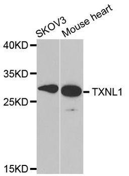 Western blot analysis of extracts of various cell lines using TXNL1 antibody