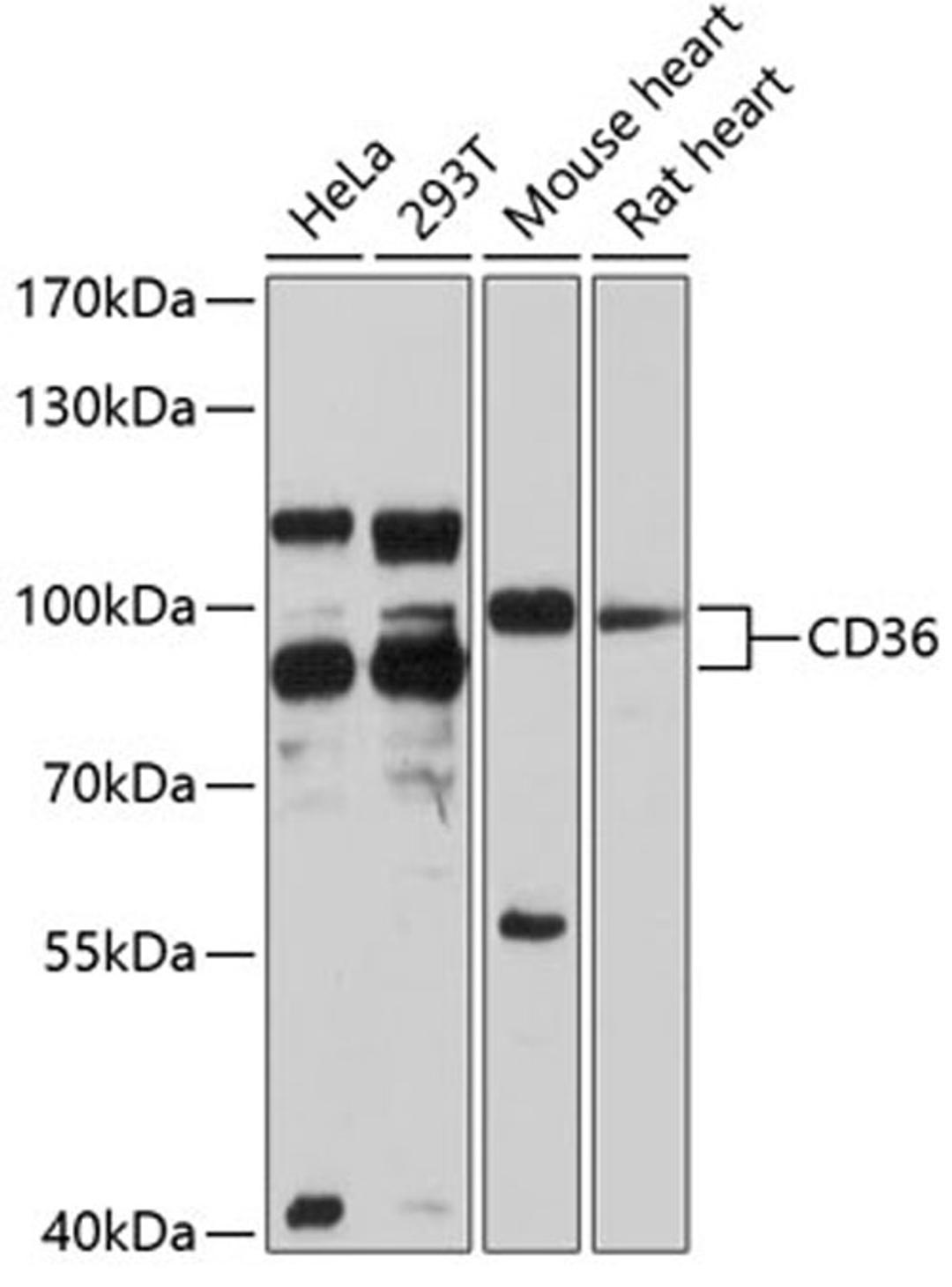 Western blot - CD36 antibody (A1470)