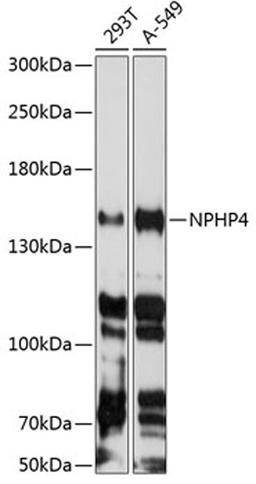 Western blot - NPHP4 antibody (A8934)