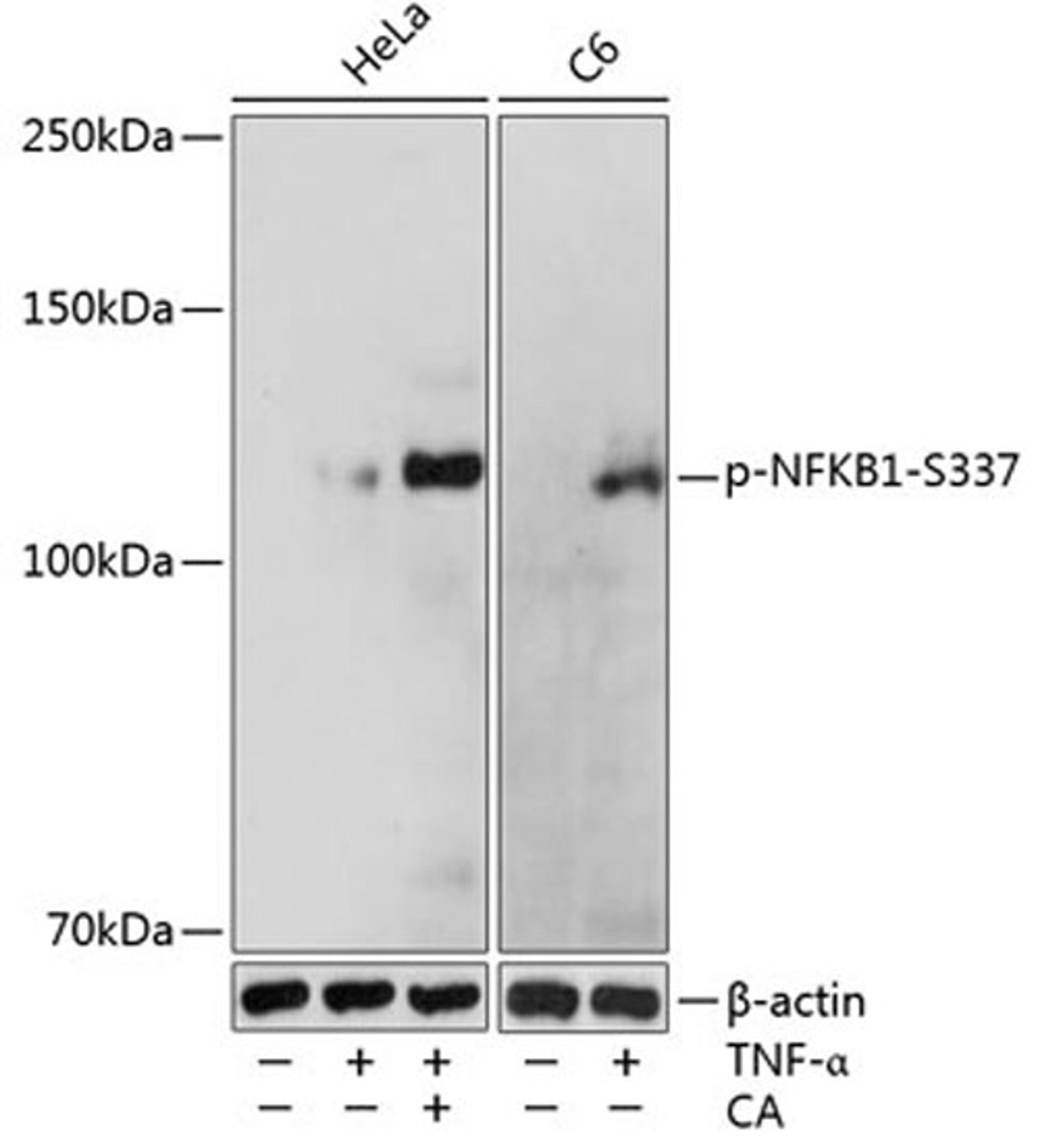 Western blot - Phospho-NFKB1-S337 pAb (AP0125)