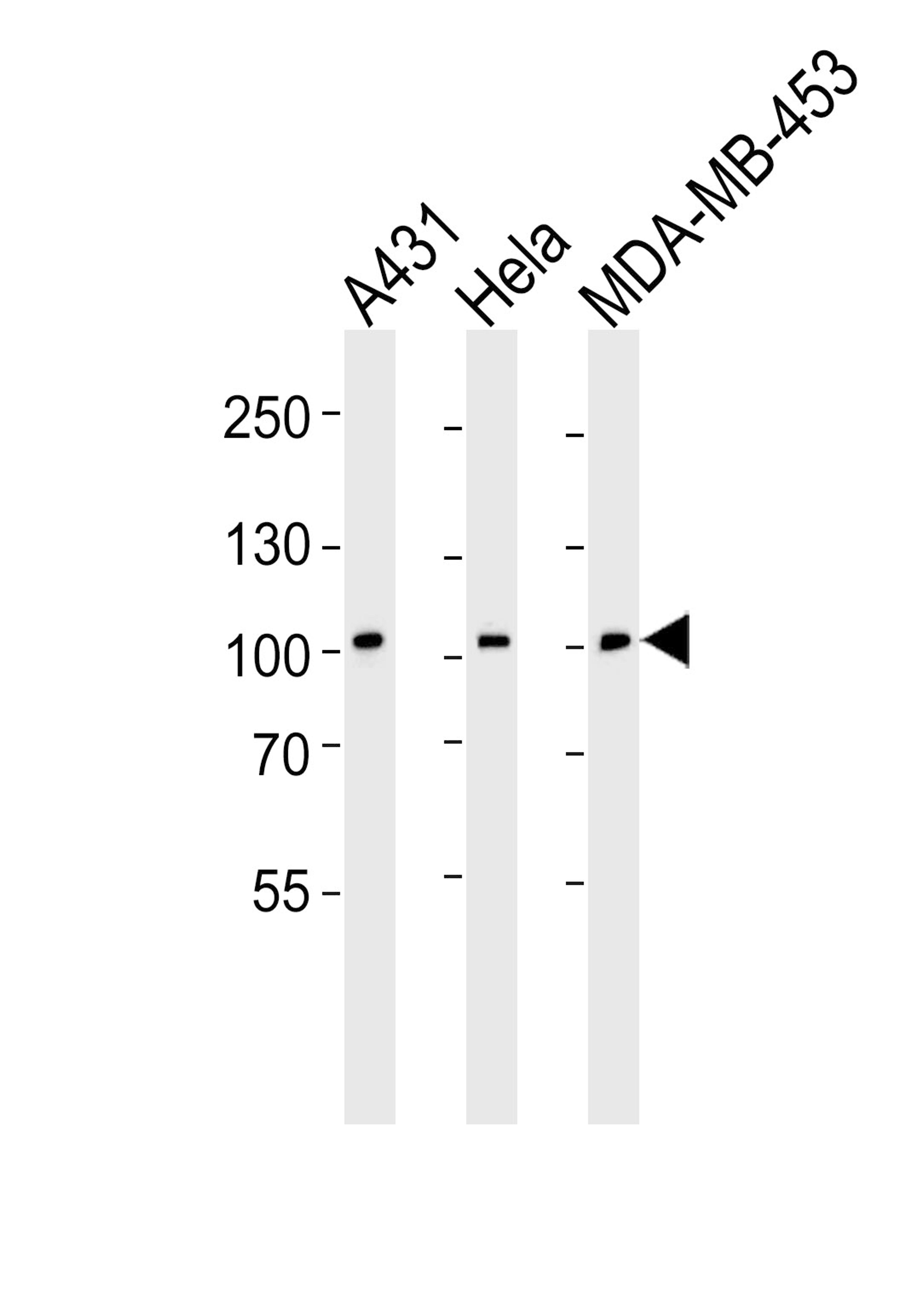 Western blot analysis of lysates from A431, Hela, MDA-MB-453 cell line (from left to right), using EPHB1 Antibody (H970) at 1:1000 at each lane.