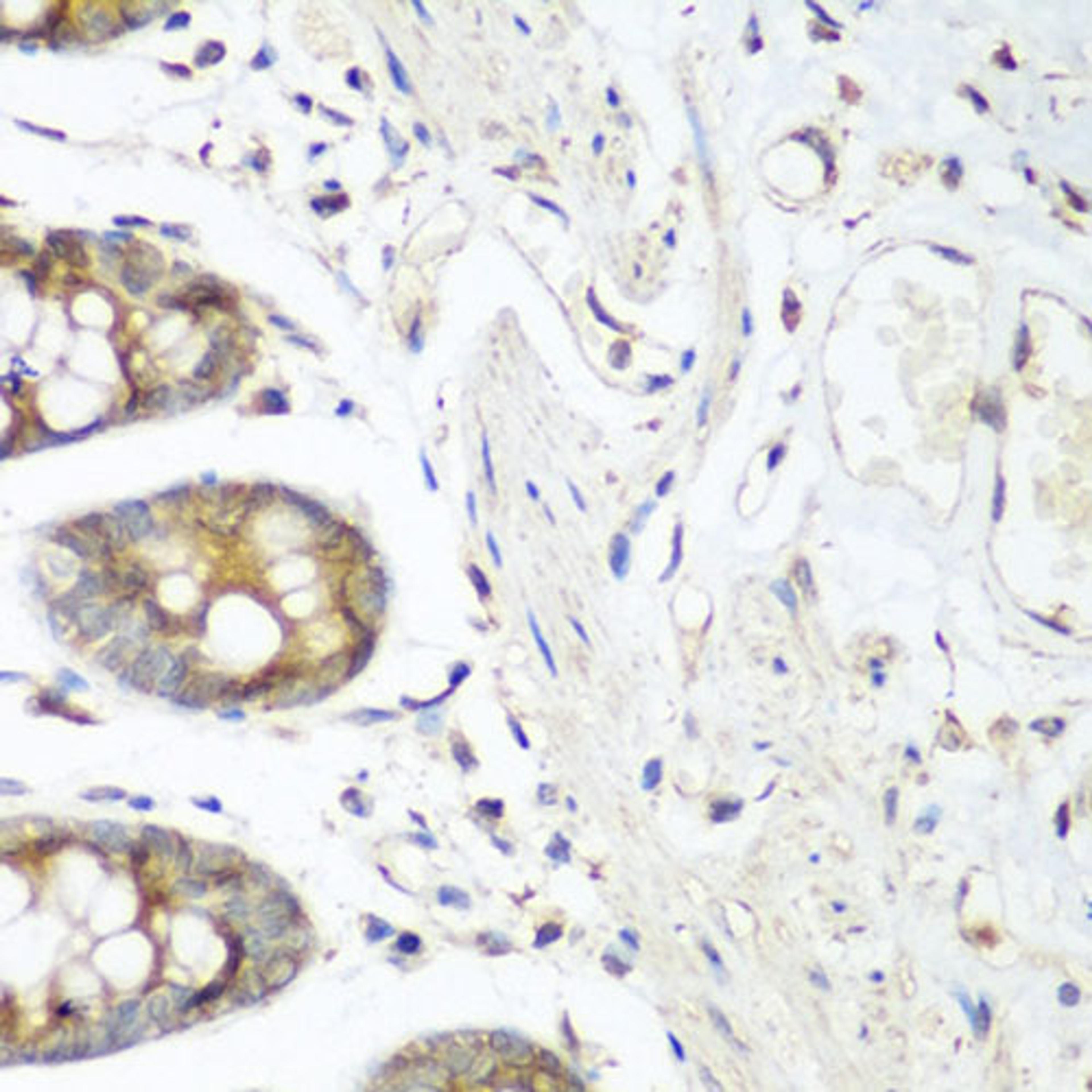 Immunohistochemistry  - FLT4 antibody (A5605)