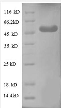 (Tris-Glycine gel) Discontinuous SDS-PAGE (reduced) with 5% enrichment gel and 15% separation gel.