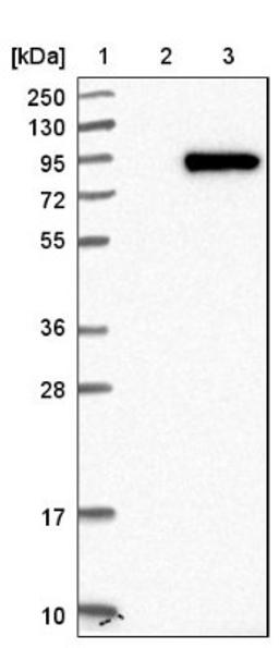 Western Blot: LRRN2 Antibody [NBP1-84686] - Lane 1: Marker [kDa] 250, 130, 95, 72, 55, 36, 28, 17, 10<br/>Lane 2: Negative control (vector only transfected HEK293T lysate)<br/>Lane 3: Over-expression lysate (Co-expressed with a C-terminal myc-DDK tag (~3.1 kDa) in mammalian HEK293T cells, LY404491)