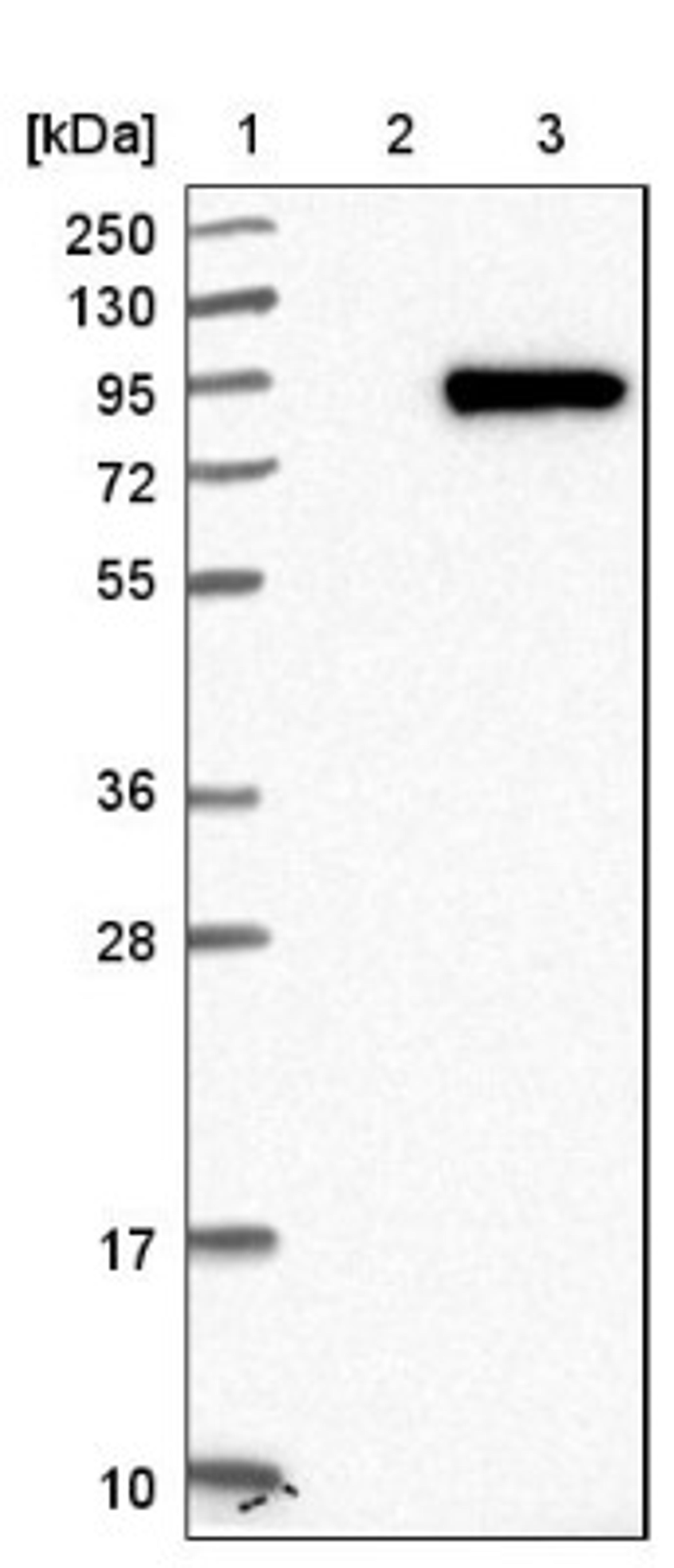 Western Blot: LRRN2 Antibody [NBP1-84686] - Lane 1: Marker [kDa] 250, 130, 95, 72, 55, 36, 28, 17, 10<br/>Lane 2: Negative control (vector only transfected HEK293T lysate)<br/>Lane 3: Over-expression lysate (Co-expressed with a C-terminal myc-DDK tag (~3.1 kDa) in mammalian HEK293T cells, LY404491)