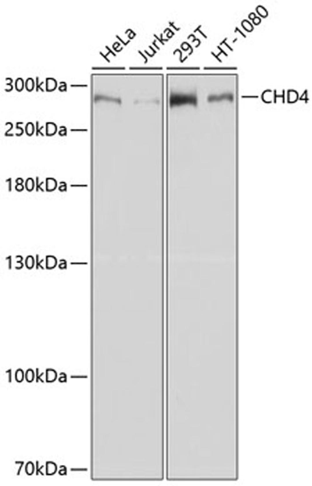 Western blot - CHD4 antibody (A11574)