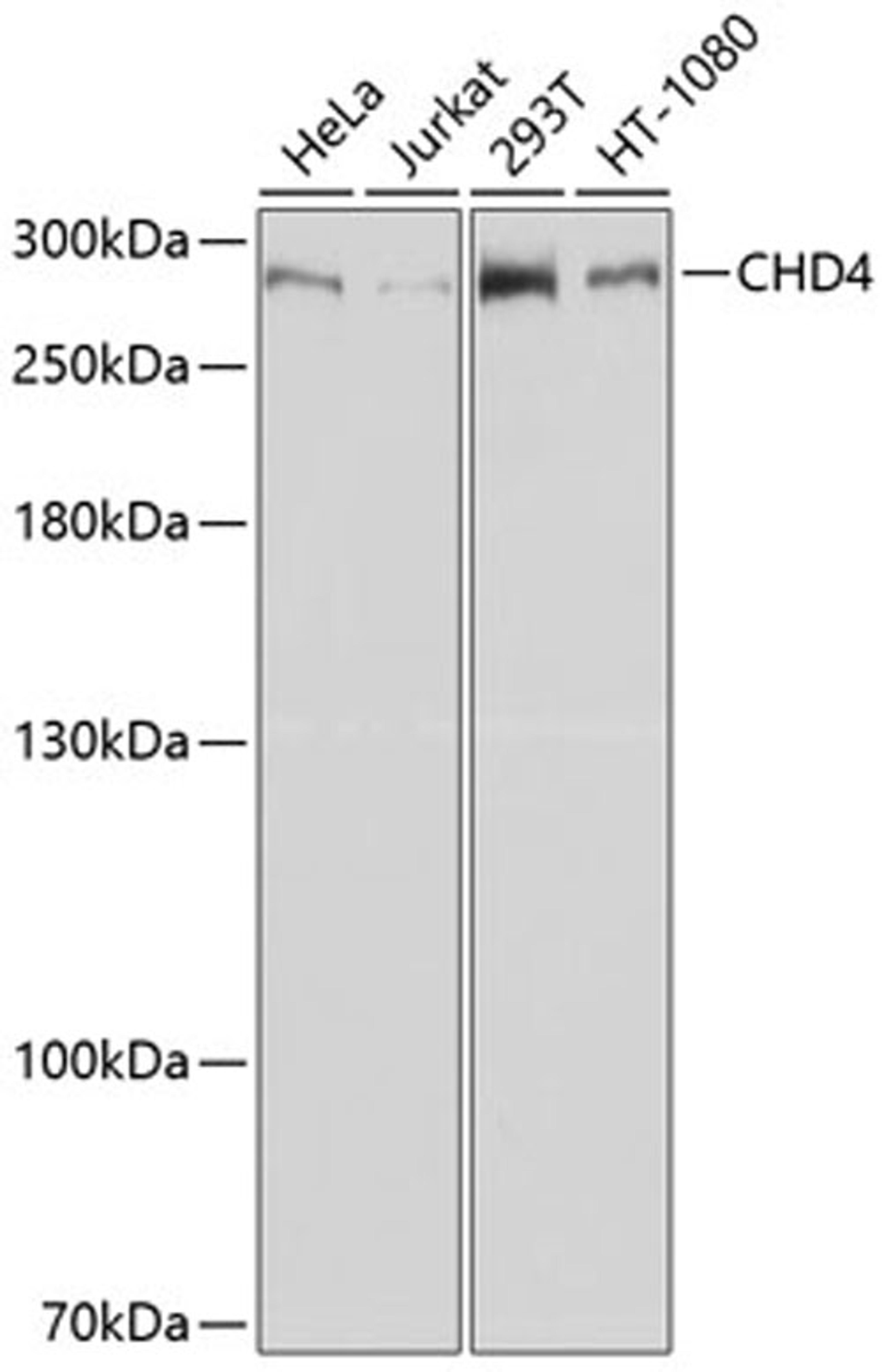 Western blot - CHD4 antibody (A11574)