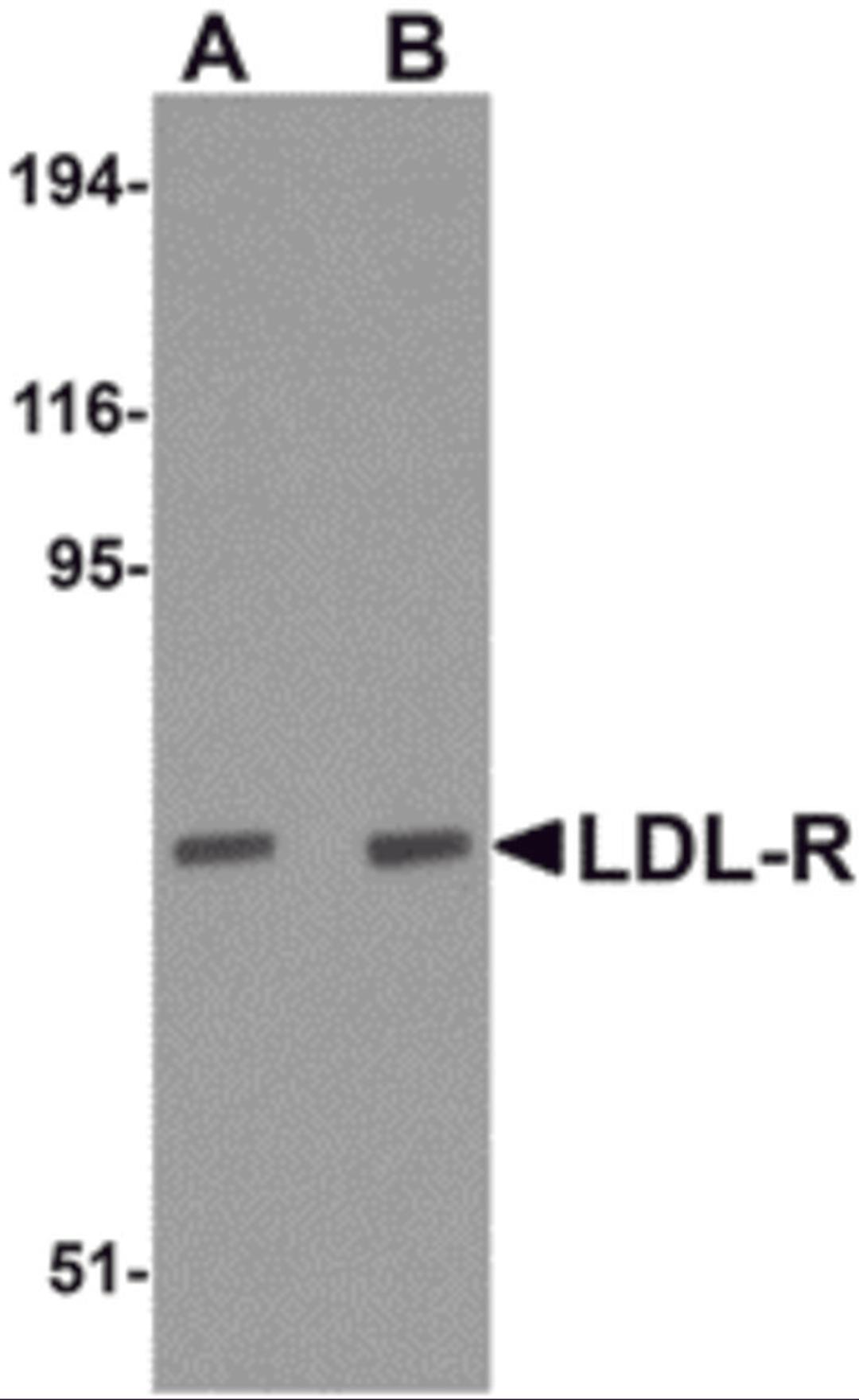 Western blot analysis of LDL-R in human liver tissue lysate with LDL-R antibody at (A) 1 and (B) 2 μg/mL.