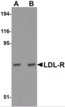 Western blot analysis of LDL-R in human liver tissue lysate with LDL-R antibody at (A) 1 and (B) 2 μg/mL.
