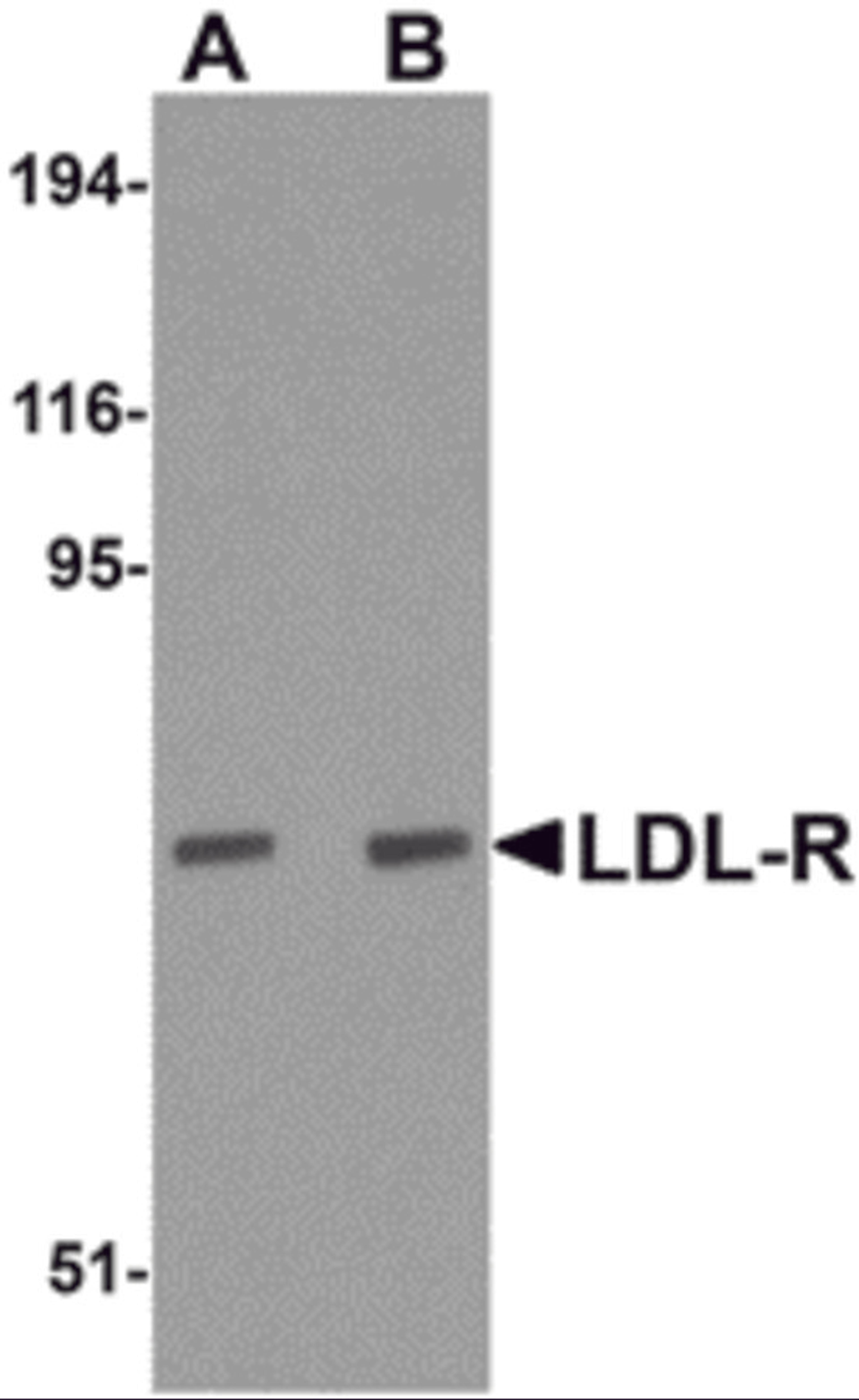 Western blot analysis of LDL-R in human liver tissue lysate with LDL-R antibody at (A) 1 and (B) 2 μg/mL.