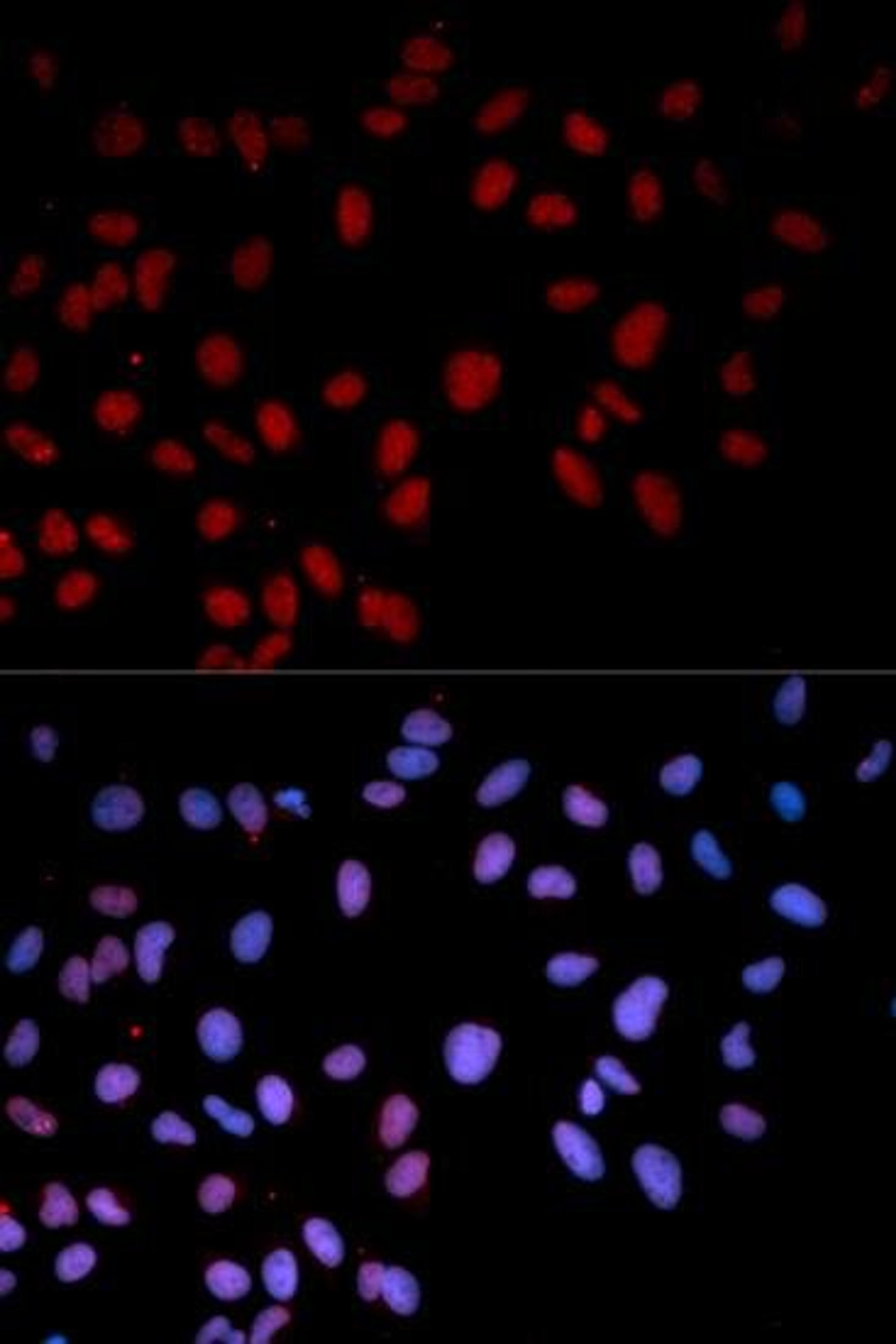 Immunofluorescence analysis of U2OS cell using MAPK14 (phospho-Thr180) antibody